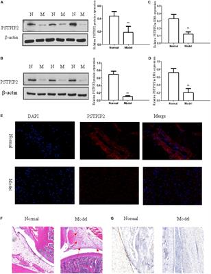 PSTPIP2 Inhibits the Inflammatory Response and Proliferation of Fibroblast-Like Synoviocytes in vitro